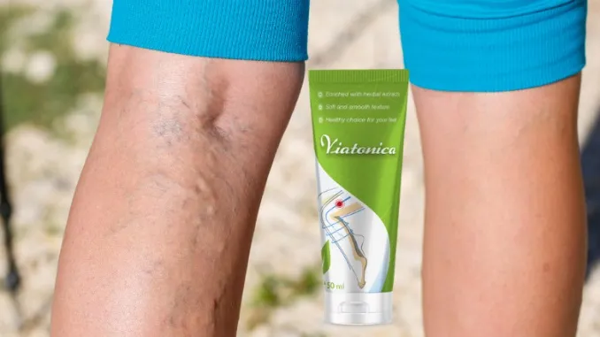 Varicozy